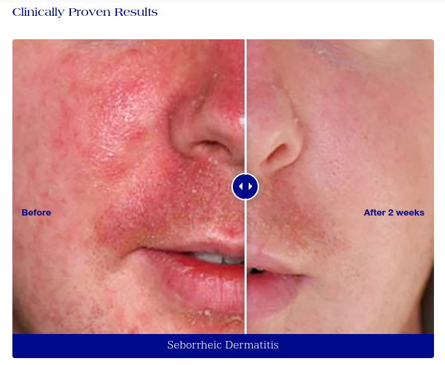 iS Clinical, Pro-Heal Serum Advance 30ml