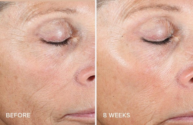 iS Clinical Active Peel System kuorivat hoitoliinat