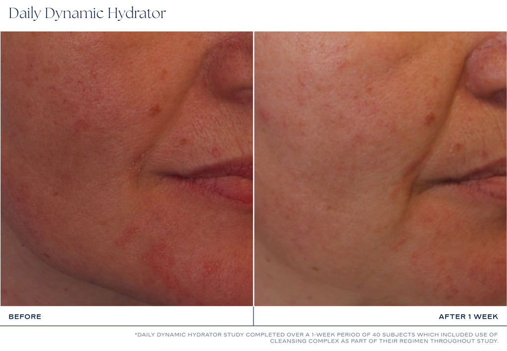 iS Clinical, Daily Dynamic Hydrator Kosteusvoide