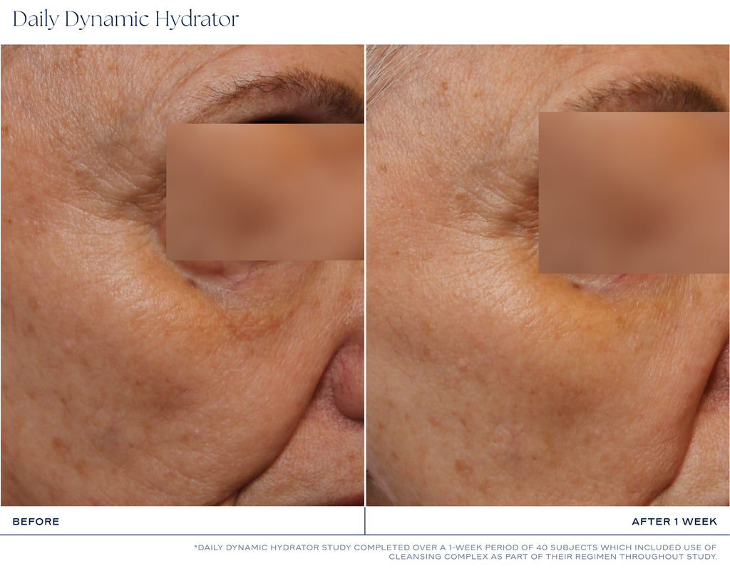 iS Clinical, Daily Dynamic Hydrator Kosteusvoide