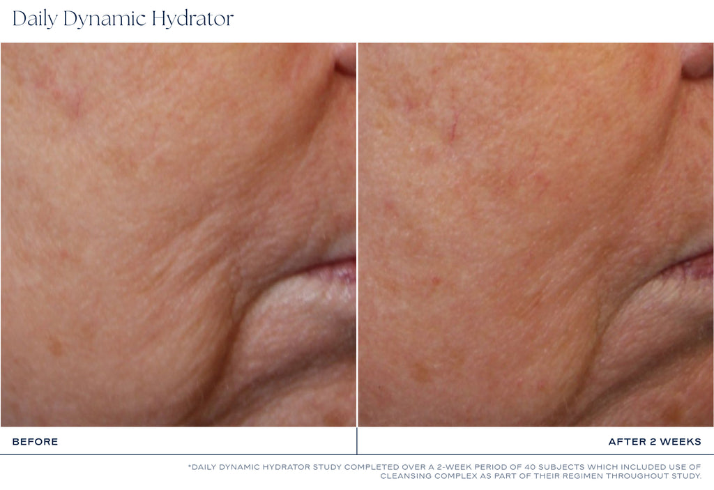 iS Clinical, Daily Dynamic Hydrator Kosteusvoide