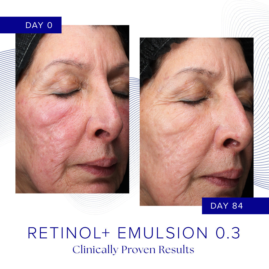 iS Clinical RETINOL+ EMULSION 0.3 retinolivoide