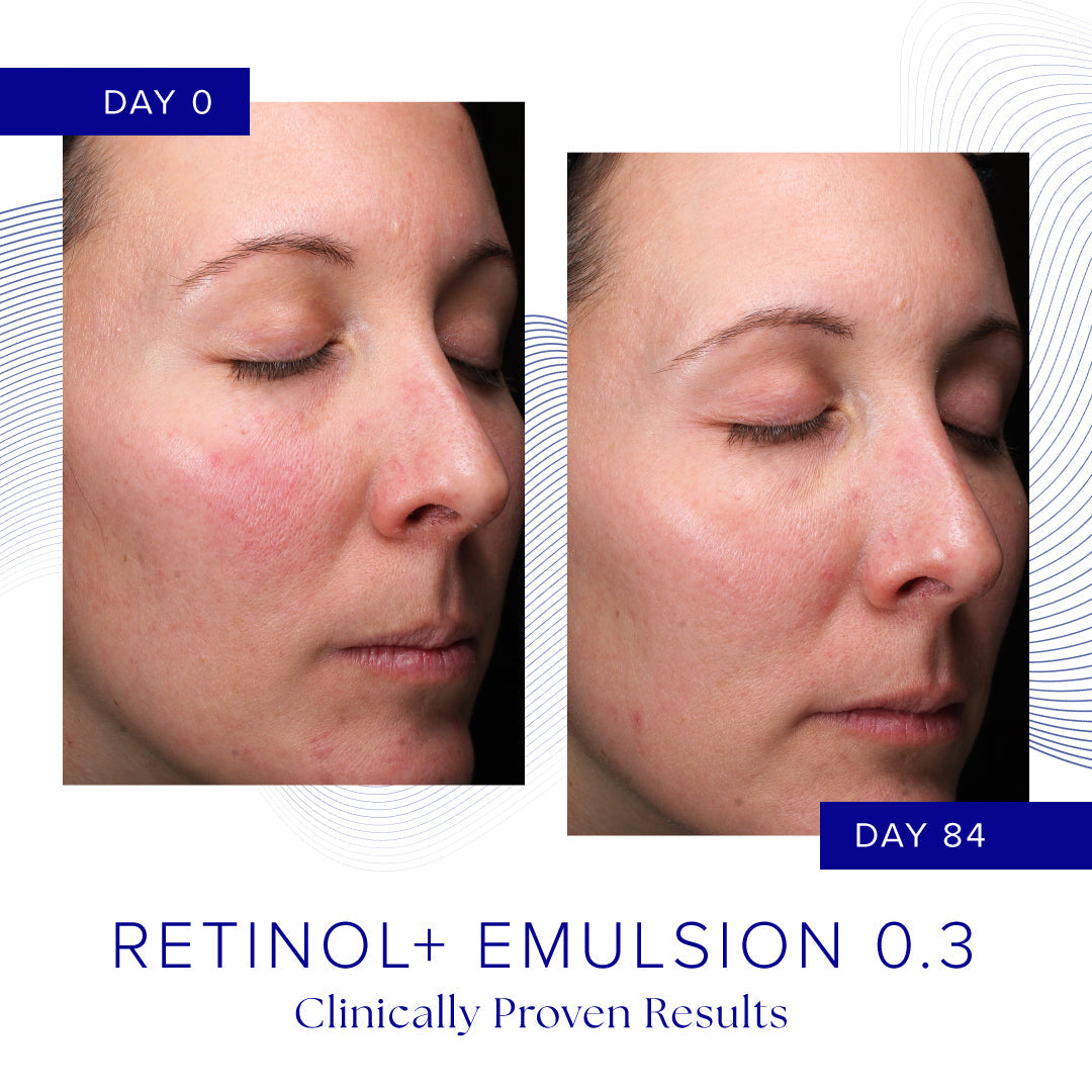 iS Clinical RETINOL+ EMULSION 0.3 retinolivoide