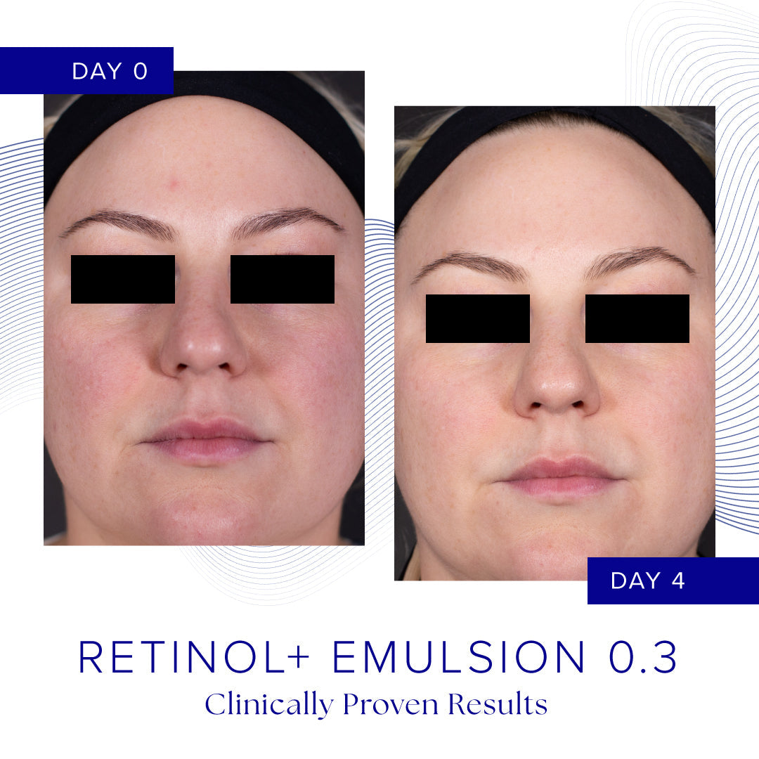 iS Clinical RETINOL+ EMULSION 0.3 retinolivoide