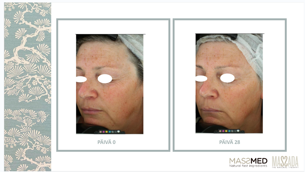 Massada, IMMACULATE CREAM SMART BIORETINOL